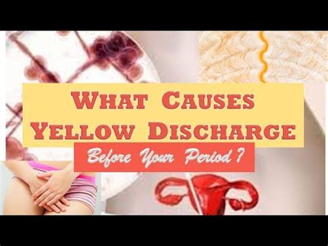 What Causes Yellow Discharge Before Your Period YouTube