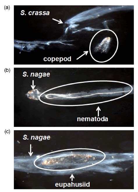 Photomicrographs Of The Chaetognaths Gut Contents A Copepod In