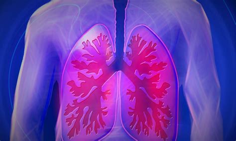 Causes Of Cystic Fibrosis Clevertopic