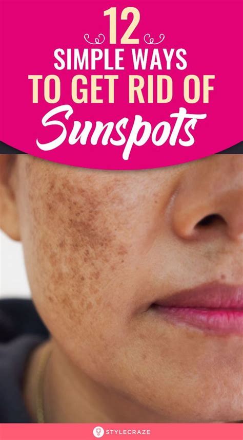 12 Simple Ways To Get Rid Of Sunspots In 2020 Sun Spots On Skin Sunspots Sunspots On Face
