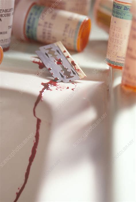 Suicide Attempt Stock Image C0123717 Science Photo