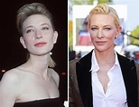 Cate Blanchett Before and After Plastic Surgery: Teeth, Face, Nose, Boobs