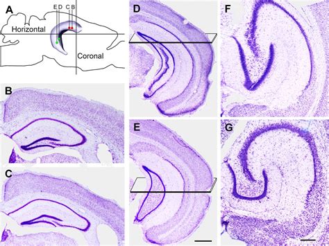 Mossy Cells In The Dorsal And Ventral Dentate Gyrus Differ In Their