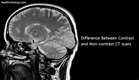 What Is The Difference Between Contrast And Non Contrast Ct Scans By Dr