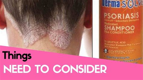 The Best Shampoos For Scalp Psoriasis Reviews And Buyers Guide