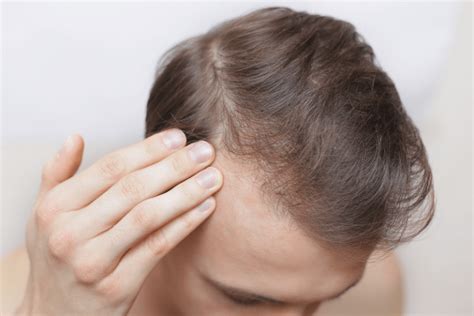 Itchy Scalp Causes And Connections To Hair Loss Trichology