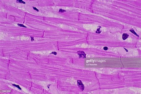 Cardiac Muscle With Intercalated Discs Human Involuntary Muscle H E