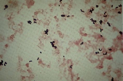 Listeria Monocytogenes Gram Stain Csf Img Vip