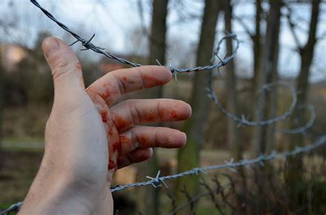 The Thief Grabbed The Newly Stretched Barbed Wire And Bled From His