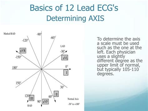 Ppt Determining Axis 12 Lead Ecgs Powerpoint Presentation Id2568340