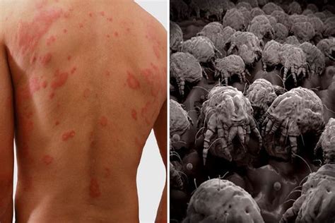 Check Out This Simple Diy Dust Mites In Your Bed Are Making You Sick