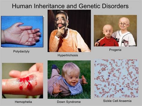 Diseases And Disorders Inherited Diseases And Disorders