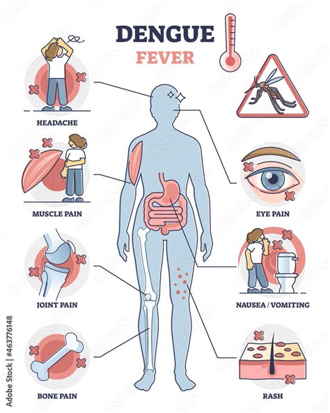 Dengue Fever Symptoms Awareness Poster Educational Vector Illustration