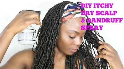 Flakes and an itchy scalp are the main symptoms of dandruff which is considered a mild form of eczema known as seborrhoeic dermatitis. DIY ITCHY SCALP Dry Scalp & DANDRUFF Spray/Jungle Barbie ...