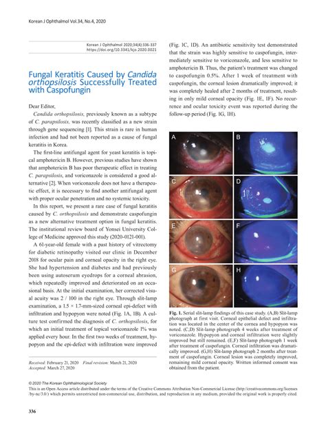 Pdf A Case Of Fungal Keratitis Caused By Candida Orthopsilosis