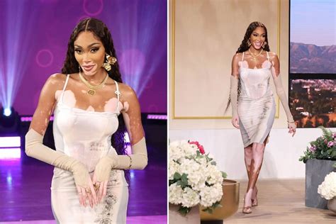 What Winnie Harlow Wore On The Show This Week