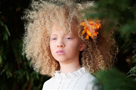 ava clarke and shala edney on why albinism is the perfect flaw essence