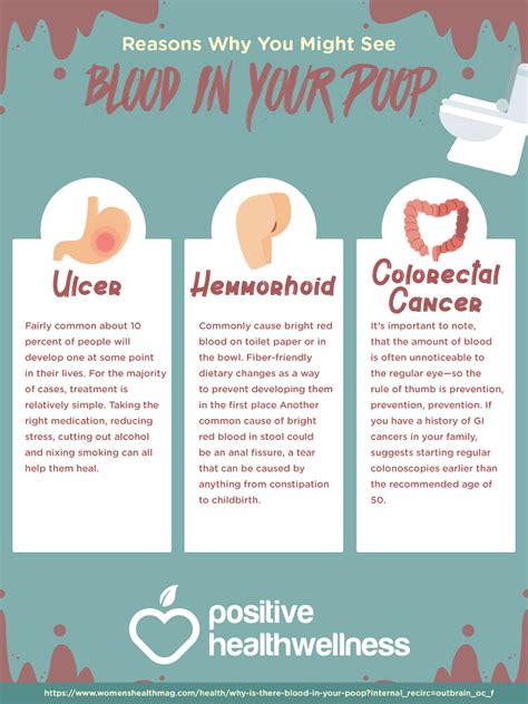 4 Reasons Why You Might See Blood In Your Poop Infographic Positive