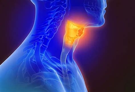What Are Warning Signs Of Head And Neck Cancer Symptoms
