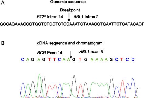 A Novel Bcr Abl1 Fusion Gene And Its Transcript In A Cml Case A Download Scientific Diagram