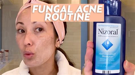 Treat Fungal Acne With This Skincare Routine Skincare Youtube