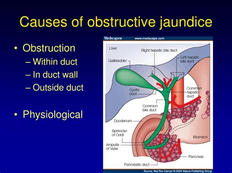 Ppt Liver Failure And Jaundice Powerpoint Presentation Free Download