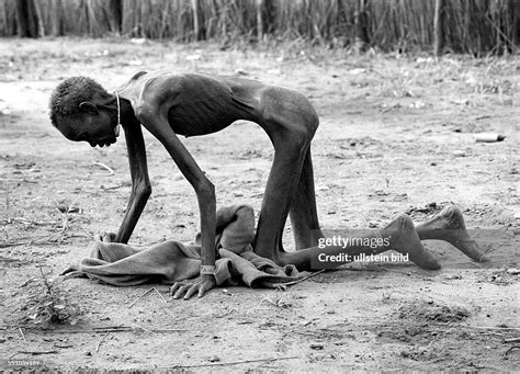A Starving Woman In A Feeding Centre In Ayod In The South Of Sudan News