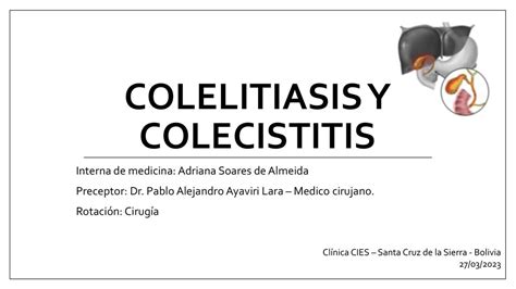 Colelitiasis Y Colecistitis Adriana S Almeida Udocz