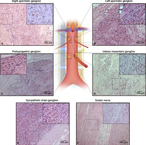 Anatomy Of The Nerves And Ganglia Of The Aortic Plexus In Males