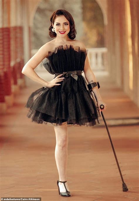 Cancer Survivor Becomes A One Legged Pin Up Girl After Having Her Limb