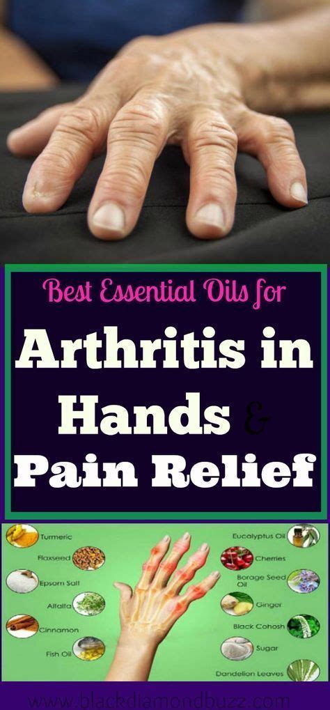 Discover Here On How To Get Rid Of Arthritis In Fingers With This 7