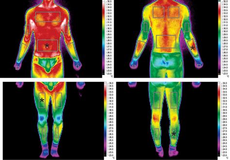 Daily Oscillations Of Skin Temperature In Military Personnel Using