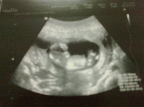 Memasuki usia kandungan 8 bulan (hamil 8 bulan) ibu mungkin mulai merasa lelah mejalani kehamilan. My lil' Family: Gambar scan 12 minggu++