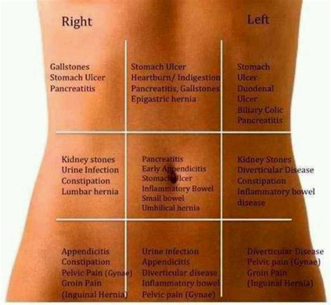 Anatomy quadrants / abdominal assessment for the correctional nurse: Pinterest: Discover and save creative ideas