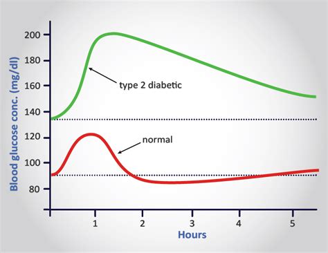 Diabetes Type 1 And Type 2 The Medical Biochemistry Page