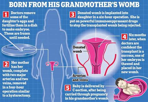 Womb Transplants To Give Three British Women Hope Of Getting Pregnant