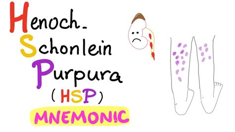 Henoch Schonlein Purpura Arthritis