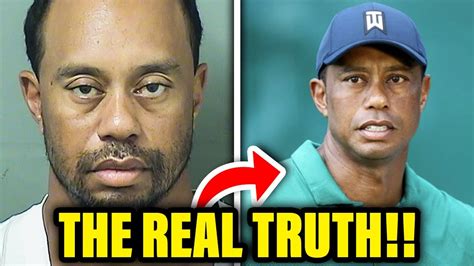 The Real Truth About Tiger Woods Plastic Surgery Youtube