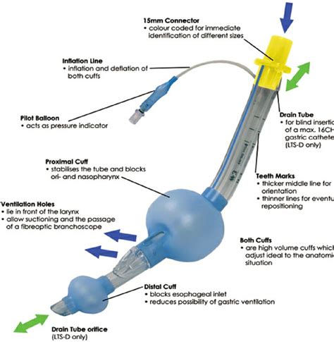 Figure 1 From Comparing The Performance Of The Laryngeal Tube Suction