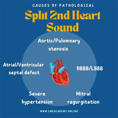 Heart Sounds