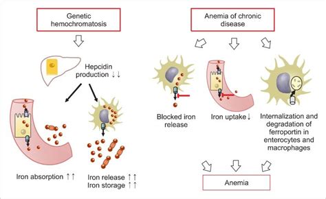 Anemia may arise as a complication of several chronic diseases, and chronic kidney disease (ckd) in particular. Pathophysiology of hemochromatosis and anemia of chronic ...