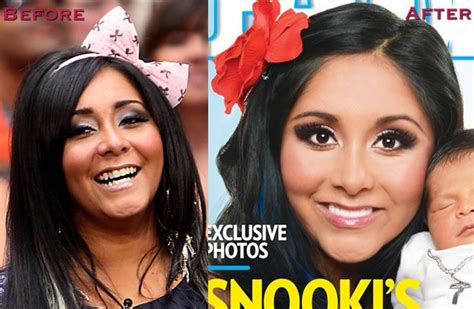 snooki before and after veneers celebrity veneers pinterest teeth smile and dental