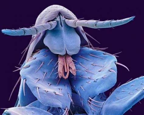 Human Flea Up Close Scanning Electron Microscope Things Under A