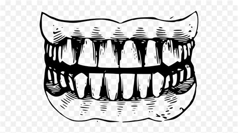 Gritted Teeth Black And White Vector Illustration Bruxism Rapper