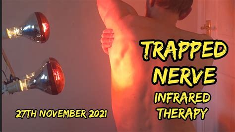 Trapped Nerve Treatment Session Infrared Heat Lamp 27th November