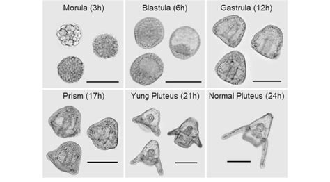 Embryo Larval Development Of Sea Urchin L Variegatus In Brackets Are