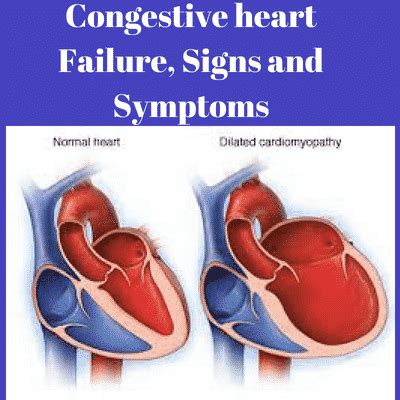 Symptoms of heart failure (at rest or during exercise). Congestive Heart Failure Symptoms, Causes, Risk Factors ...