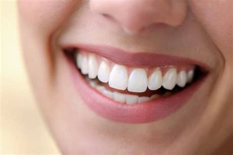 Teeth Whitening You Deserve A Beautiful Smile American Dental Clinic