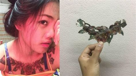 Tattoo Removal Fiasco This Thailand Girls Shocking Story Will Make