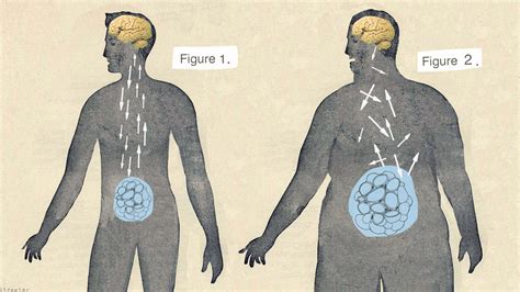 Calling Obesity A Disease May Make It Easier To Get Help Shots